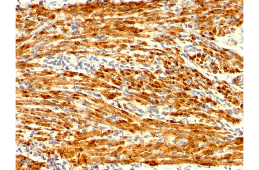 Immunohistochemistry - Anti-Calponin 1 Antibody [CNN1/1408R] - BSA and Azide free (A251424) - Antibodies.com