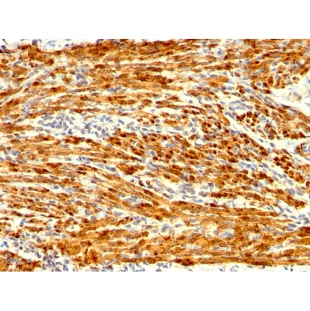 Immunohistochemistry - Anti-Calponin 1 Antibody [CNN1/1408R] - BSA and Azide free (A251424) - Antibodies.com