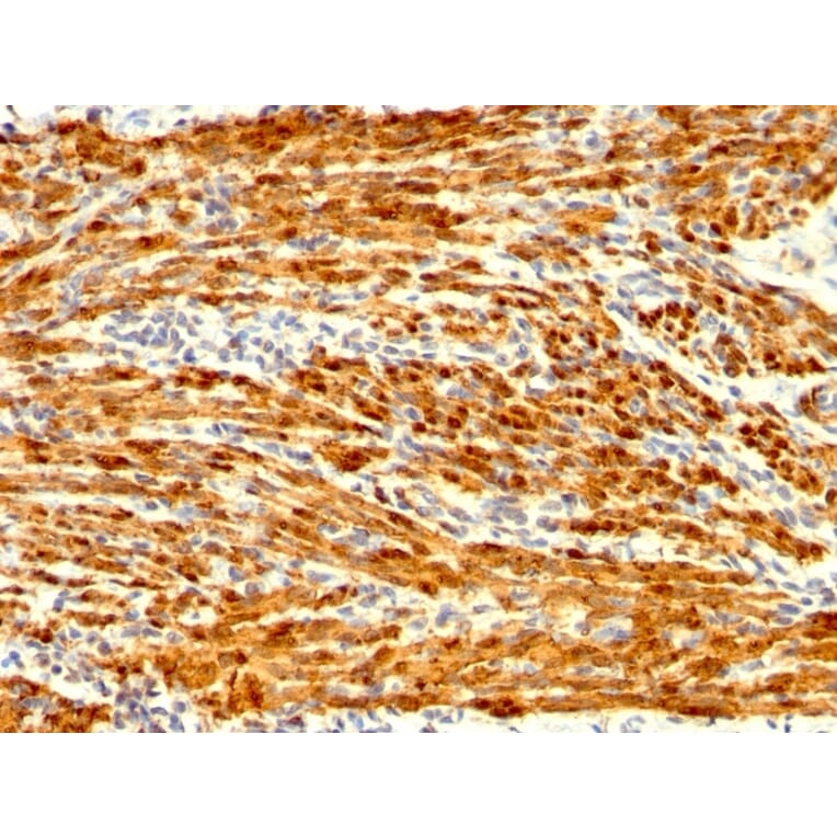 Immunohistochemistry - Anti-Calponin 1 Antibody [CNN1/1408R] - BSA and Azide free (A251424) - Antibodies.com