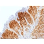 Immunohistochemistry - Anti-Calponin 1 Antibody [CNN1/1408R] - BSA and Azide free (A251424) - Antibodies.com