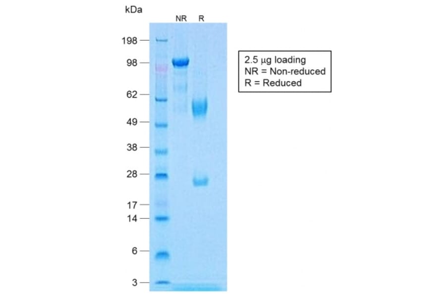 SDS-PAGE - Anti-Calponin 1 Antibody [CNN1/1408R] - BSA and Azide free (A251424) - Antibodies.com