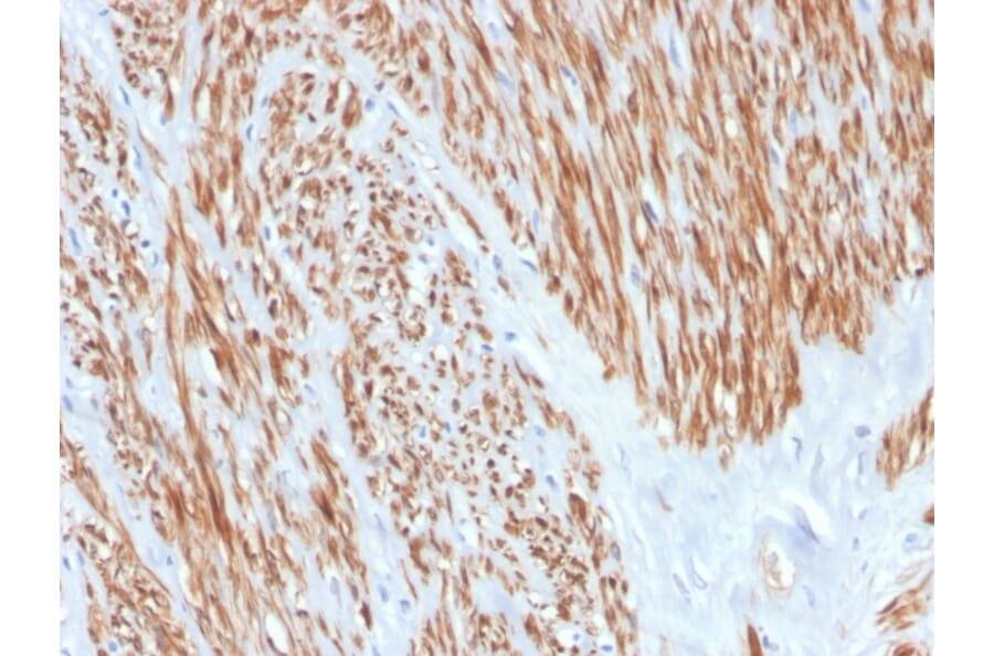 Immunohistochemistry - Anti-Calponin 1 Antibody [CNN1/4227R] - BSA and Azide free (A251425) - Antibodies.com