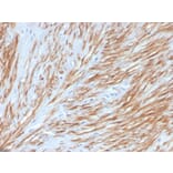 Immunohistochemistry - Anti-Calponin 1 Antibody [CNN1/4227R] - BSA and Azide free (A251424) - Antibodies.com