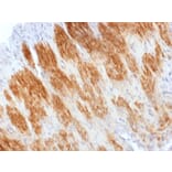 Immunohistochemistry - Anti-Calponin 1 Antibody - BSA and Azide free (A251426) - Antibodies.com