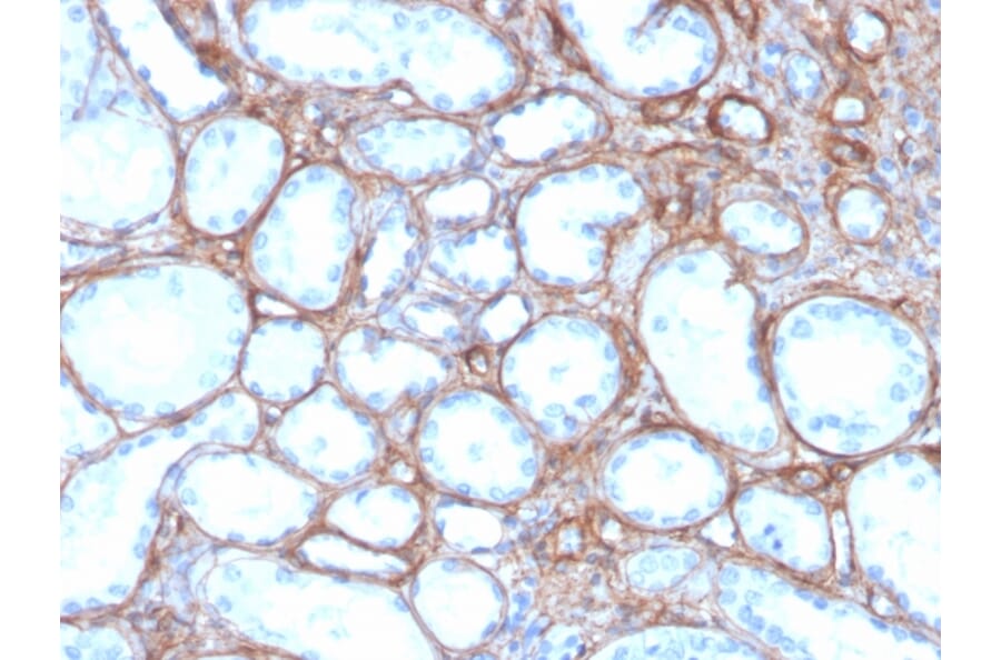 Immunohistochemistry - Anti-Collagen IV Antibody [rCOL4/4742] - BSA and Azide free (A251427) - Antibodies.com