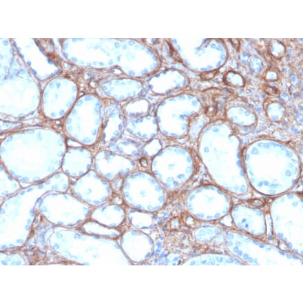 Immunohistochemistry - Anti-Collagen IV Antibody [rCOL4/4742] - BSA and Azide free (A251427) - Antibodies.com