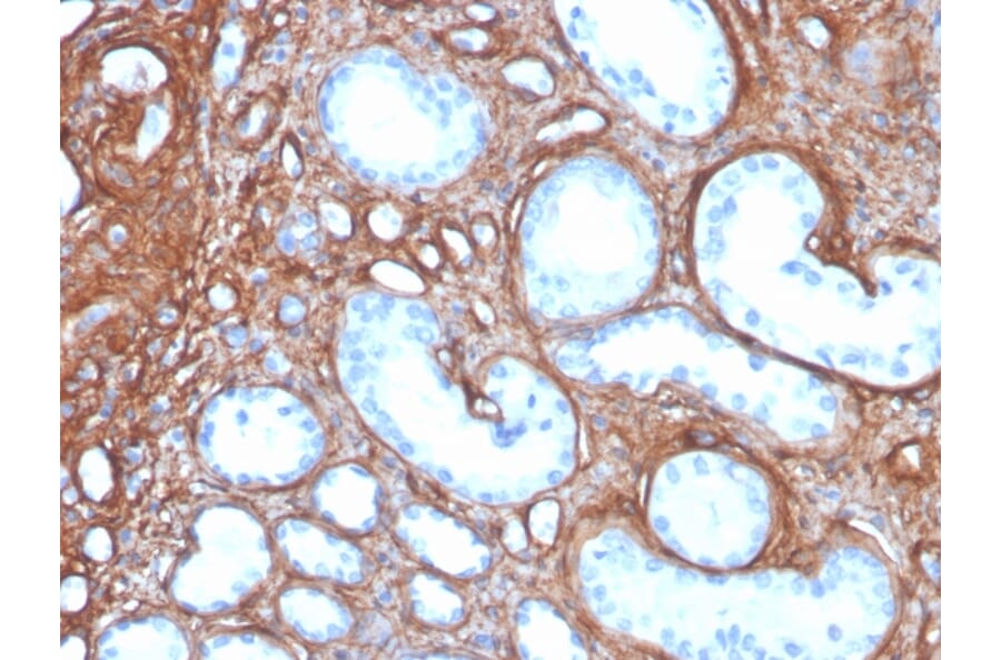 Immunohistochemistry - Anti-Collagen IV Antibody [rCOL4/4742] - BSA and Azide free (A251426) - Antibodies.com