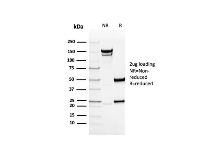 SDS-PAGE - Anti-Collagen IV Antibody [rCOL4/4742] - BSA and Azide free (A251427) - Antibodies.com