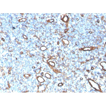 Immunohistochemistry - Anti-Collagen IV Antibody [COL4/4241R] - BSA and Azide free (A251429) - Antibodies.com