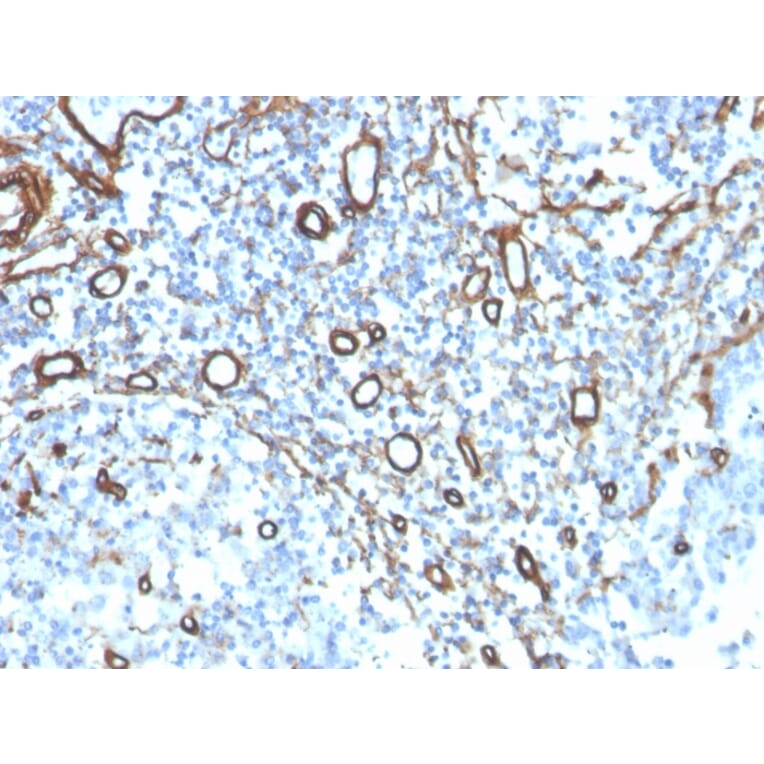 Immunohistochemistry - Anti-Collagen IV Antibody [COL4/4241R] - BSA and Azide free (A251428) - Antibodies.com