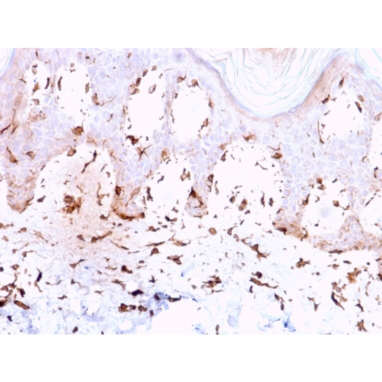 Immunohistochemistry - Anti-Collagen VII Antibody [LH7.2] - BSA and Azide free (A251430) - Antibodies.com