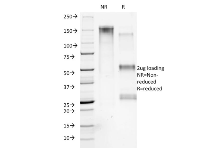 SDS-PAGE - Anti-Collagen VII Antibody [LH7.2] - BSA and Azide free (A251430) - Antibodies.com