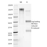 SDS-PAGE - Anti-Collagen VII Antibody [LH7.2] - BSA and Azide free (A251430) - Antibodies.com