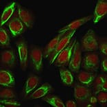Immunofluorescence - Anti-Collagen VII Antibody [LH7.2] - BSA and Azide free (A251430) - Antibodies.com