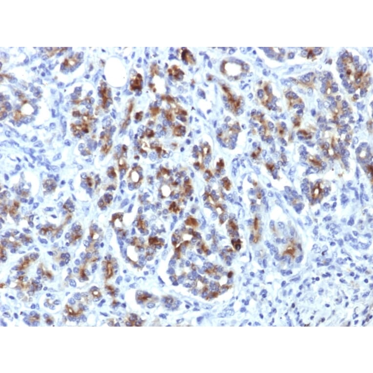 Immunohistochemistry - Anti-alpha 1 Antichymotrypsin Antibody [AACT/1451] - BSA and Azide free (A251430) - Antibodies.com