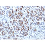 Immunohistochemistry - Anti-alpha 1 Antichymotrypsin Antibody [AACT/1451] - BSA and Azide free (A251430) - Antibodies.com