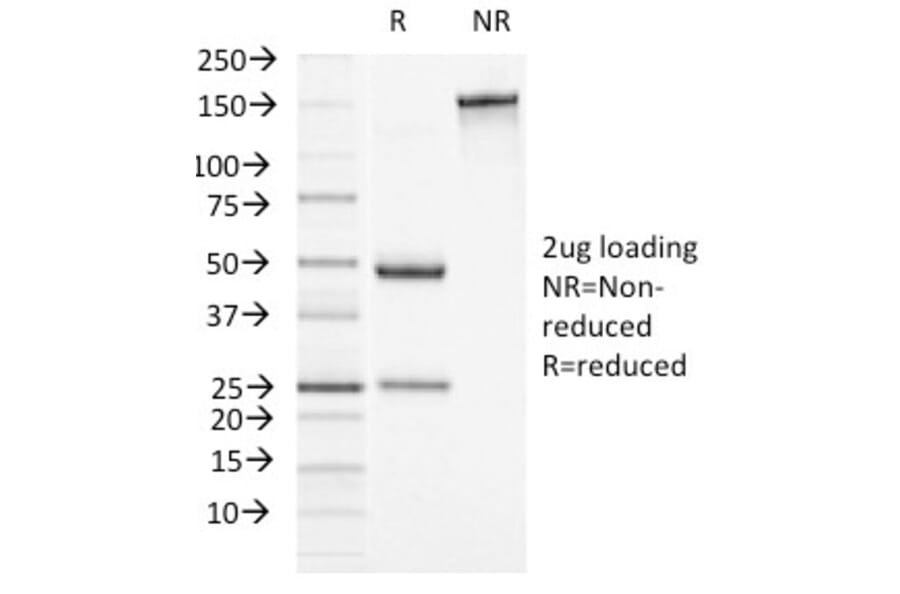 SDS-PAGE - Anti-alpha 1 Antichymotrypsin Antibody [AACT/1451] - BSA and Azide free (A251431) - Antibodies.com