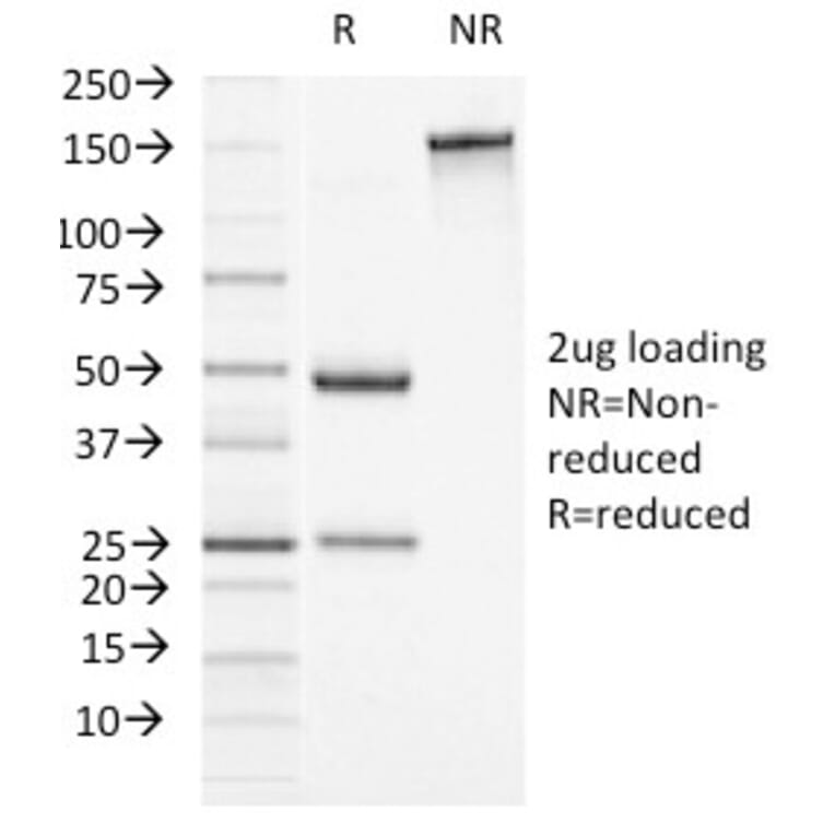 SDS-PAGE - Anti-alpha 1 Antichymotrypsin Antibody [AACT/1451] - BSA and Azide free (A251431) - Antibodies.com