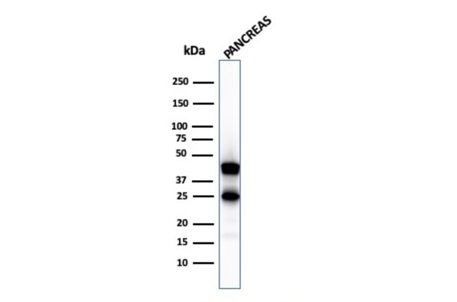 Western Blot - Anti-Carboxypeptidase A1 Antibody [CPA1/2711] - BSA and Azide free (A251433) - Antibodies.com