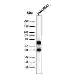 Western Blot - Anti-Carboxypeptidase A1 Antibody [CPA1/2711] - BSA and Azide free (A251433) - Antibodies.com
