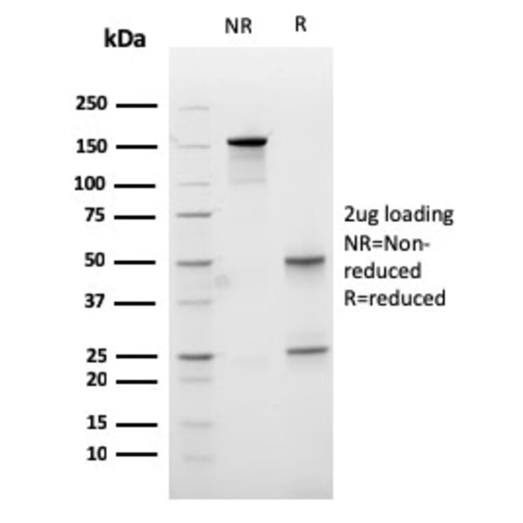 SDS-PAGE - Anti-Carboxypeptidase A1 Antibody [CPA1/2713] - BSA and Azide free (A251435) - Antibodies.com