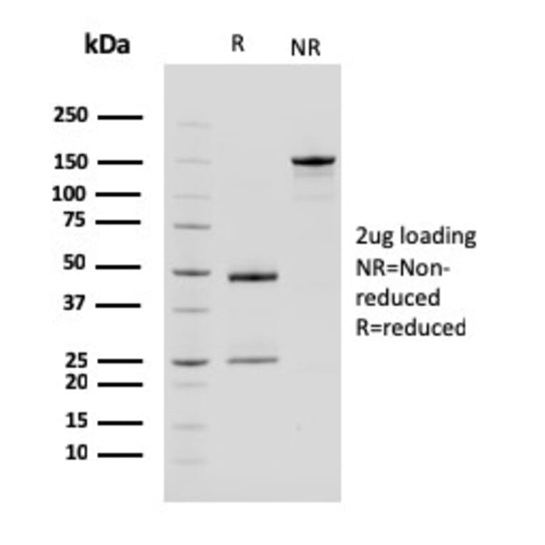 SDS-PAGE - Anti-Carboxypeptidase A1 Antibody [CPA1/2714] - BSA and Azide free (A251436) - Antibodies.com