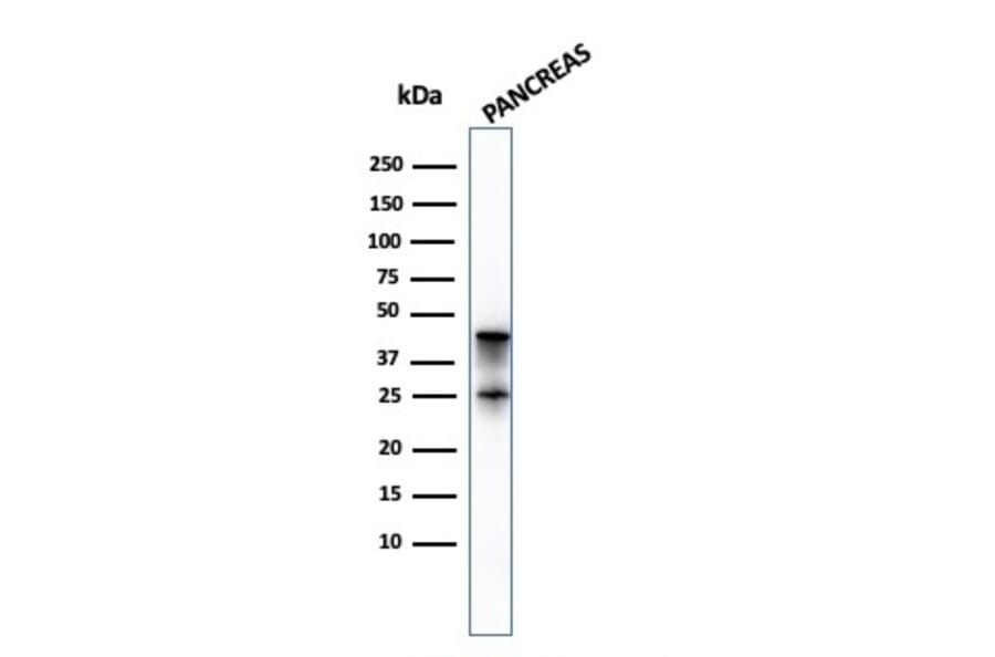 Western Blot - Anti-Carboxypeptidase A1 Antibody [CPA1/2714] - BSA and Azide free (A251436) - Antibodies.com