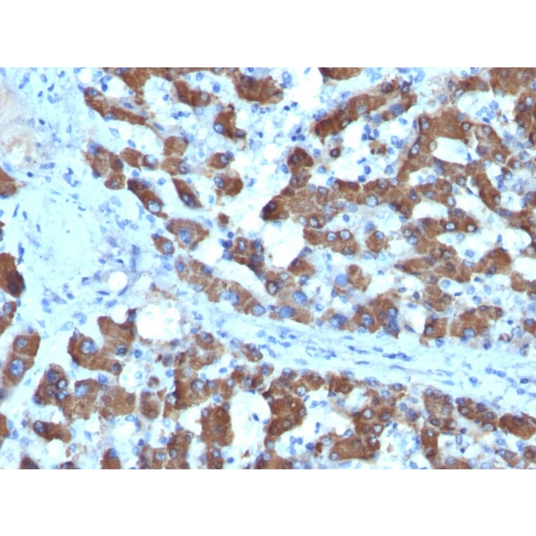 Immunohistochemistry - Anti-CPS1 Antibody [SPM615] - BSA and Azide free (A251437) - Antibodies.com