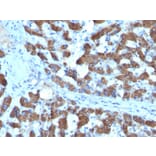 Immunohistochemistry - Anti-CPS1 Antibody [SPM615] - BSA and Azide free (A251437) - Antibodies.com