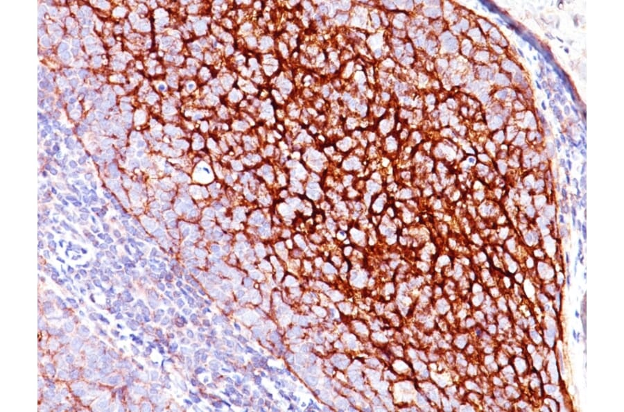 Immunohistochemistry - Anti-CD35 Antibody [E11] - BSA and Azide free (A251438) - Antibodies.com