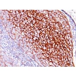 Immunohistochemistry - Anti-CD35 Antibody [E11] - BSA and Azide free (A251438) - Antibodies.com