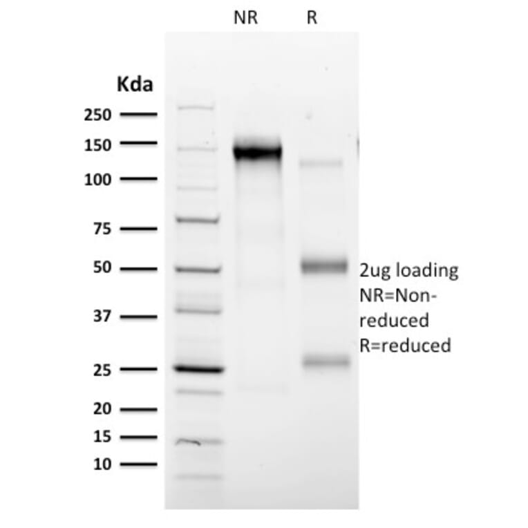 SDS-PAGE - Anti-CD35 Antibody [E11] - BSA and Azide free (A251439) - Antibodies.com