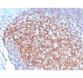 Immunohistochemistry - Anti-CD35 Antibody [SPM554] - BSA and Azide free (A251439) - Antibodies.com