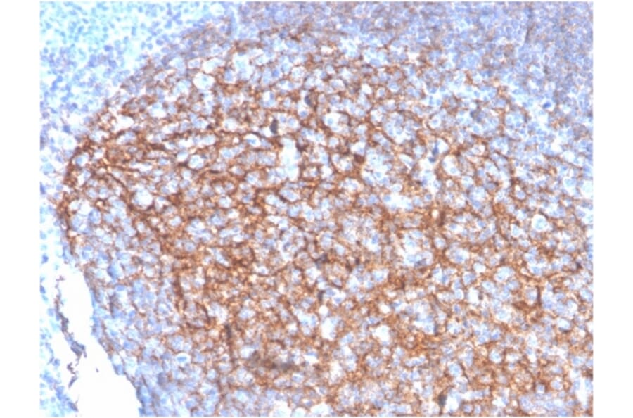 Immunohistochemistry - Anti-CD35 Antibody [SPM554] - BSA and Azide free (A251439) - Antibodies.com