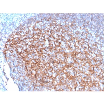 Immunohistochemistry - Anti-CD35 Antibody [SPM554] - BSA and Azide free (A251439) - Antibodies.com