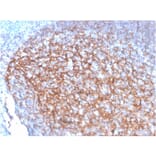 Immunohistochemistry - Anti-CD35 Antibody [SPM554] - BSA and Azide free (A251439) - Antibodies.com