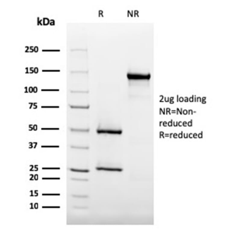 SDS-PAGE - Anti-CD35 Antibody [SPM554] - BSA and Azide free (A251440) - Antibodies.com