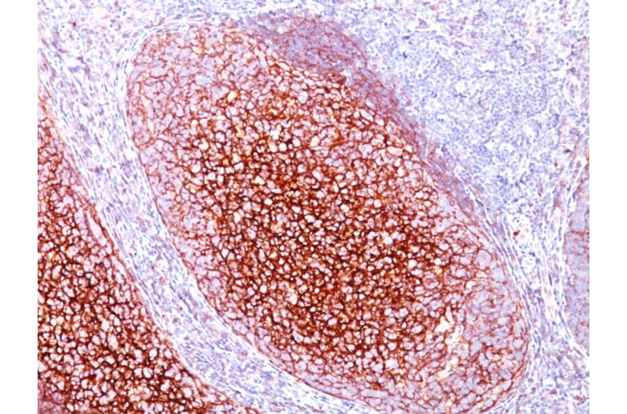 Immunohistochemistry - Anti-CD35 Antibody [CR1/802] - BSA and Azide free (A251441) - Antibodies.com