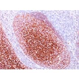 Immunohistochemistry - Anti-CD35 Antibody [CR1/802] - BSA and Azide free (A251441) - Antibodies.com