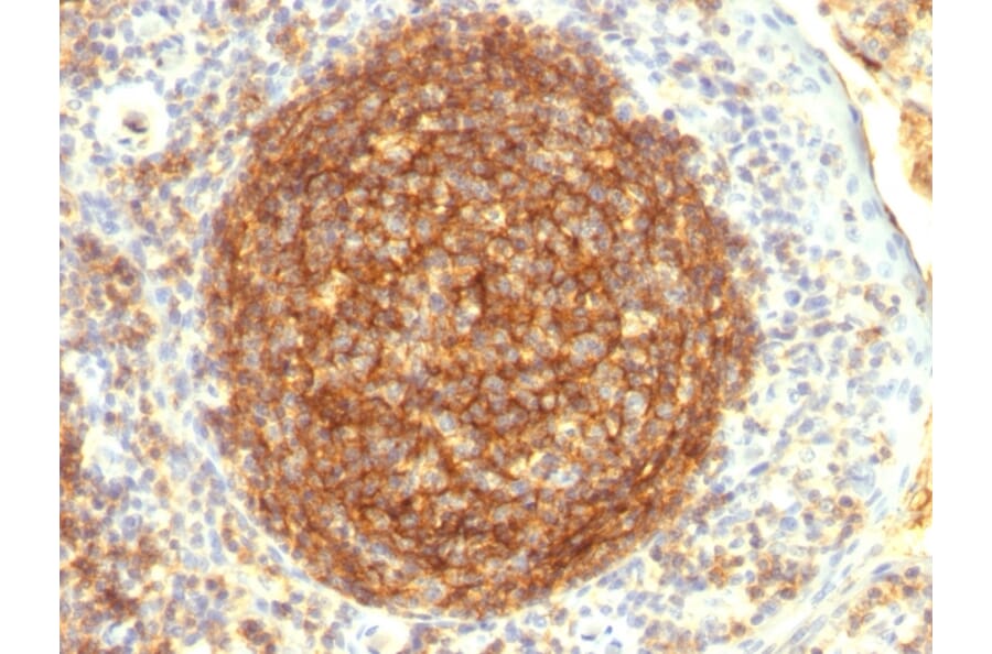 Immunohistochemistry - Anti-CD35 Antibody [CR1/802] - BSA and Azide free (A251440) - Antibodies.com