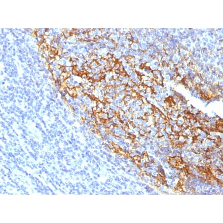 Immunohistochemistry - Anti-CD35 Antibody [To5] - BSA and Azide free (A251441) - Antibodies.com
