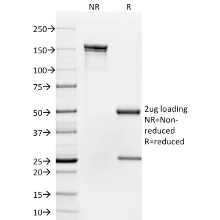 SDS-PAGE - Anti-CD35 Antibody [To5] - BSA and Azide free (A251442) - Antibodies.com