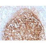 Immunohistochemistry - Anti-CD35 Antibody [CR1/4382R] - BSA and Azide free (A251443) - Antibodies.com