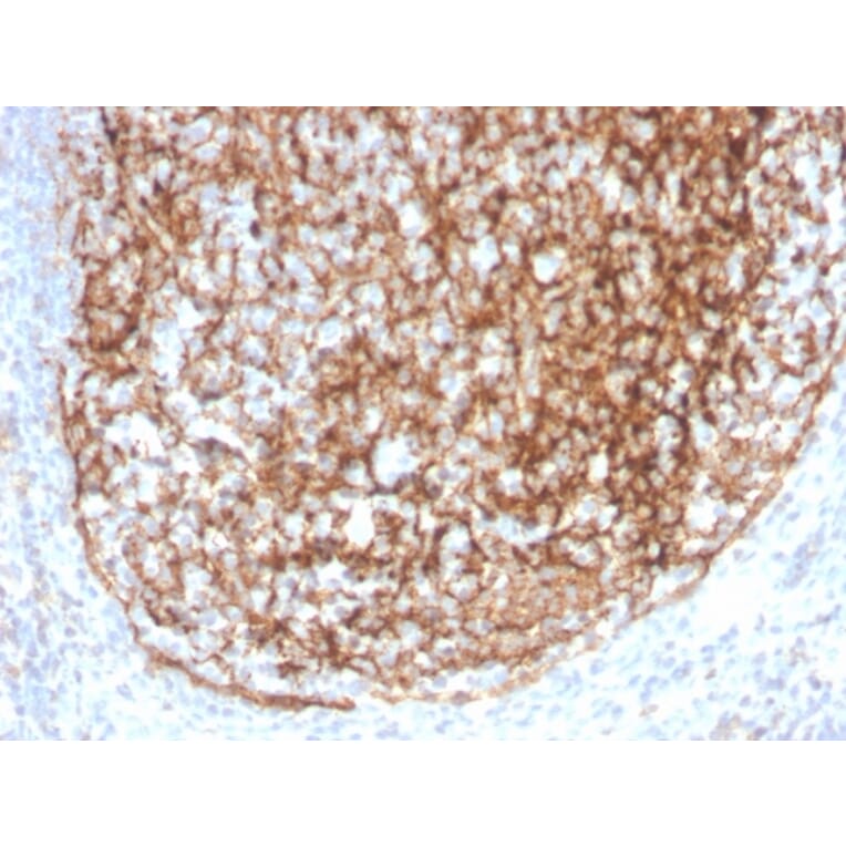 Immunohistochemistry - Anti-CD35 Antibody [CR1/4382R] - BSA and Azide free (A251442) - Antibodies.com