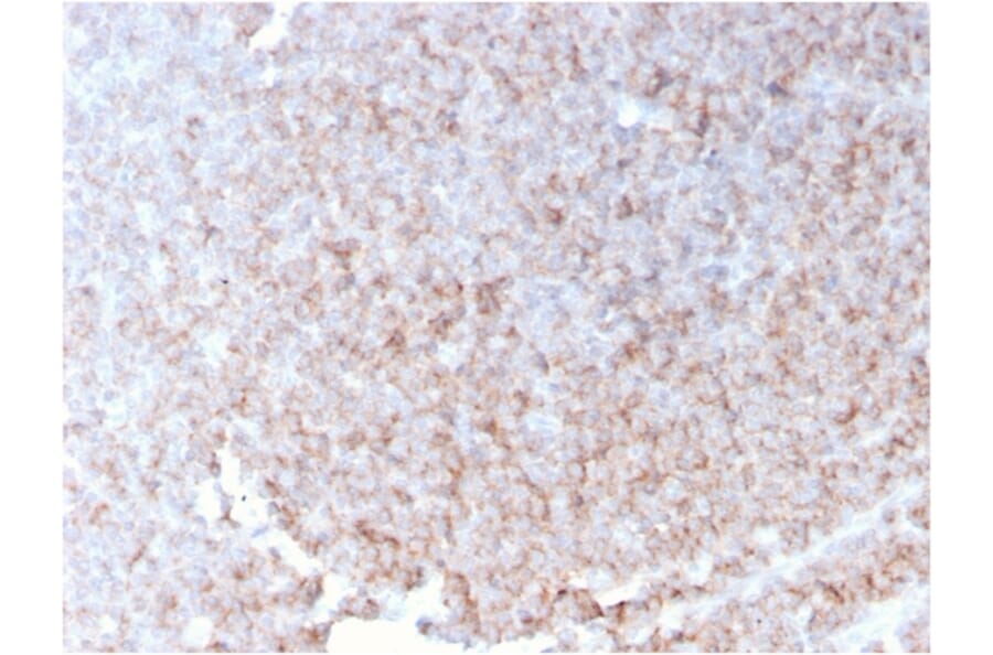 Immunohistochemistry - Anti-CD21 Antibody [rCR2/1952] - BSA and Azide free (A251444) - Antibodies.com