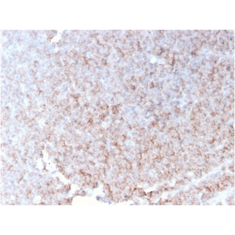 Immunohistochemistry - Anti-CD21 Antibody [rCR2/1952] - BSA and Azide free (A251444) - Antibodies.com