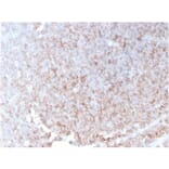 Immunohistochemistry - Anti-CD21 Antibody [rCR2/1952] - BSA and Azide free (A251444) - Antibodies.com