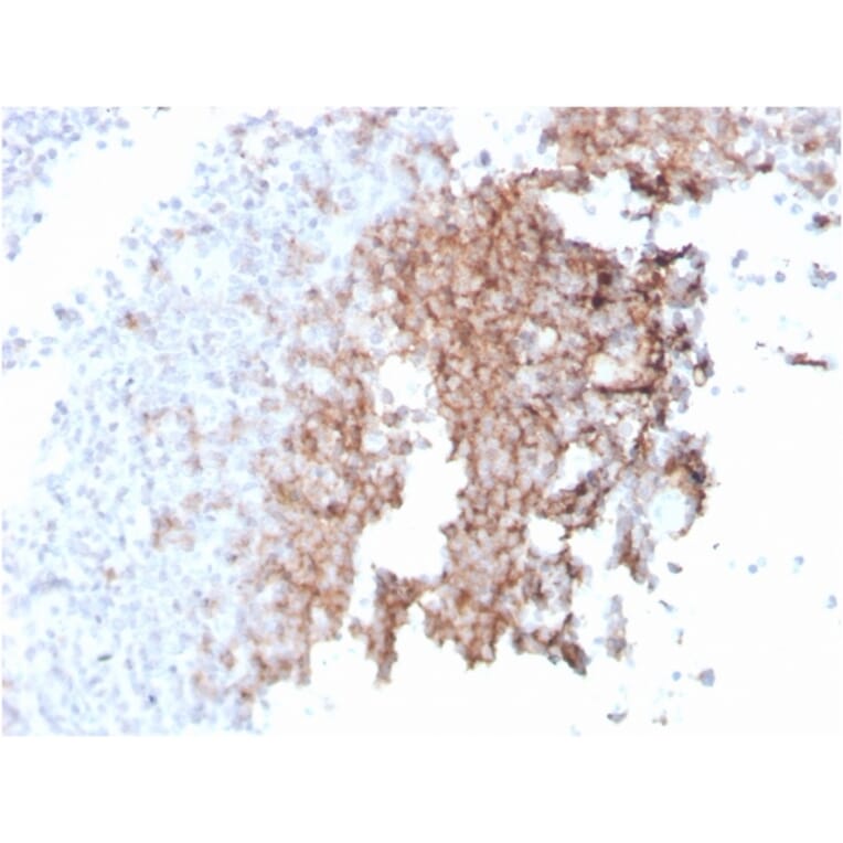 Immunohistochemistry - Anti-CD21 Antibody [rCR2/1952] - BSA and Azide free (A251443) - Antibodies.com