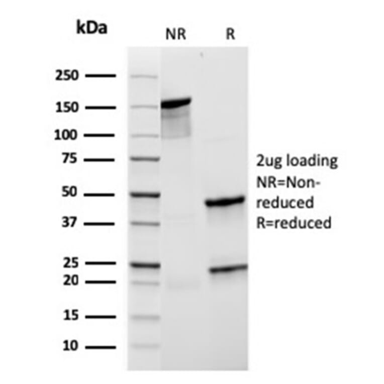 SDS-PAGE - Anti-CD21 Antibody [rCR2/1952] - BSA and Azide free (A251444) - Antibodies.com