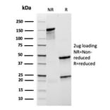 SDS-PAGE - Anti-CD21 Antibody [rCR2/1952] - BSA and Azide free (A251444) - Antibodies.com